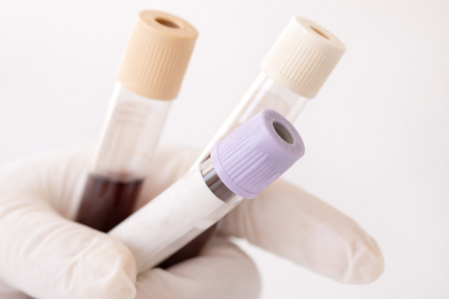 Lab (Whole Blood & Urine)